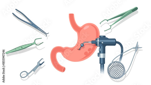 Medical Endoscopy Equipment and Surgical Tools Surrounding a Stomach Illustration for