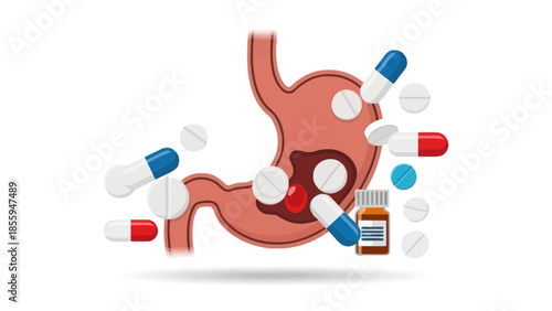 Illustration of a human stomach with various pills and medication bottles scattered around it