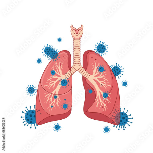 Detailed medical illustration shows human lungs infected with blue coronavirus molecules during a viral outbreak.