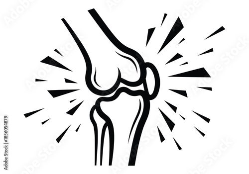 Stylized black and white illustration of a painful human knee joint with radiating lines