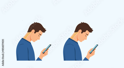 Medical illustration comparing correct and incorrect neck posture while using a smartphone, showing the strain on the spine from text neck.