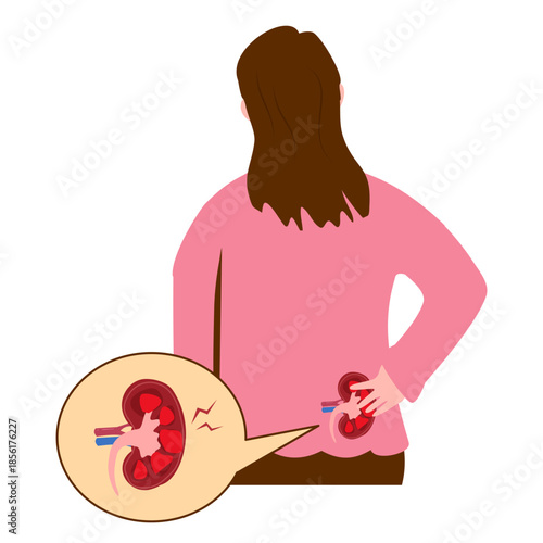 Woman experiencing kidney pain, illustration of kidney stones and backache. Kidney infection 