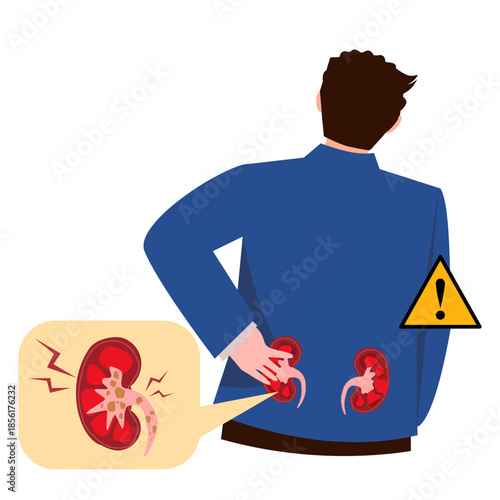 Man experiencing kidney pain, illustration of kidney stones and backache. Kidney infection 