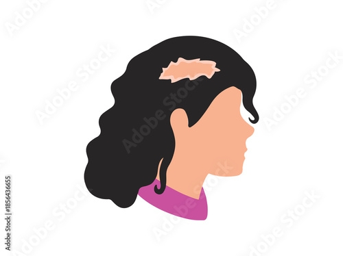 Lichen Planus Disease Clip Art

