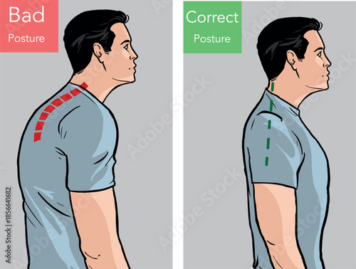 Comparison of man with good and bad back posture. Male suffer from scolisosis from sedentary work. Vector illustration.