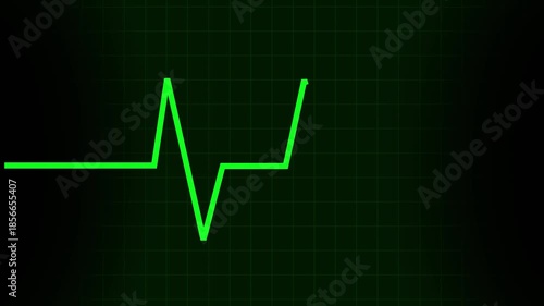 Cardiac Monitor Flatline Heartbeat Neon Line Animation, 4K Video