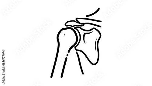 Dislocated Shoulder Joint Illustration.