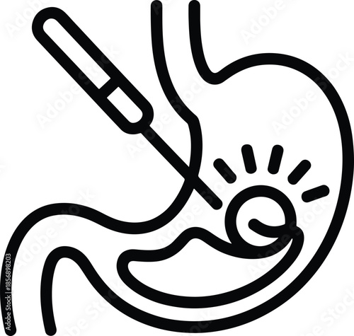 Gastroscopy Stomach Exam Examination Line Drawing