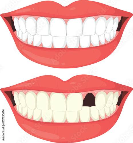Dental health and missing teeth illustration