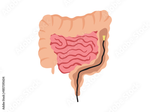 Sigmoidoscopy in Intestinal Colon Illustration
