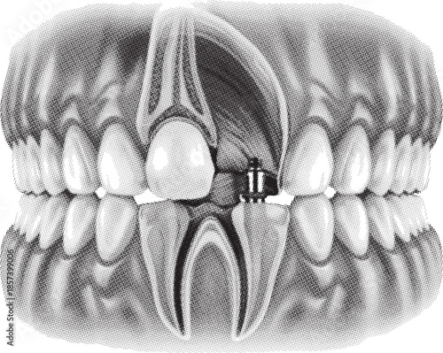 x ray image of a human head