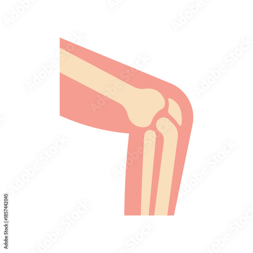 Osteoporosis Illustration