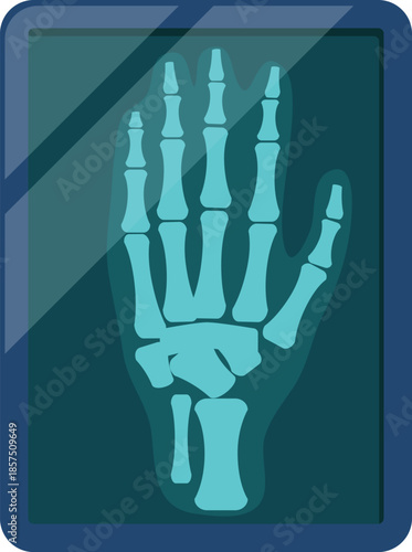 medical x-ray imaging for diagnostic purpose