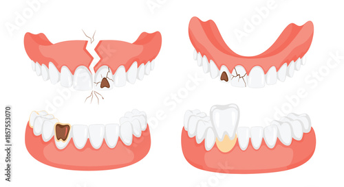 Set of vector illustrations showing various dental problems, including cracked teeth, cavities, tooth decay, and a missing tooth implant.