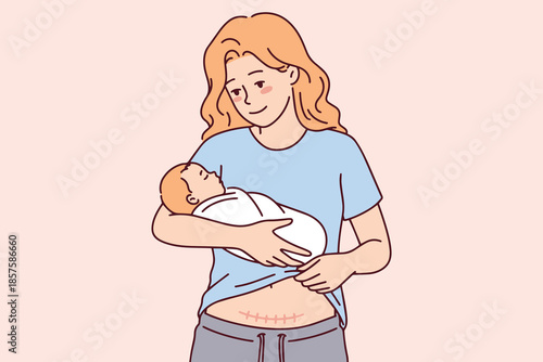 Proud woman cradles her infant child and looks down at surgical incision on her belly. Reality of motherhood and postpartum recovery after cesarean section delivery in hospital or at home.