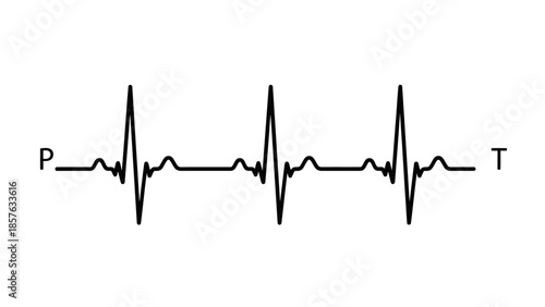 Electrocardiogram (ECG) Wave with P, QRS, T Segments, Medical Heart Rhythm, isolated white background