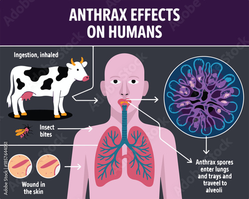 Anthrax Effects On Humans Infographic Showing Transmission And Lung Infection vector illustration