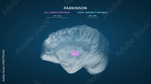 Parkinson Dopamine Loss Basal Ganglia Pathway Dysfunction on Blue Background