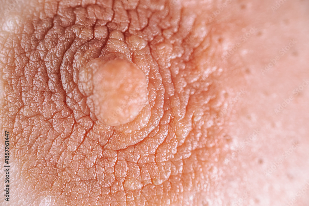 Fototapeta premium Close-up view of textured skin with intricate patterns and a prominent feature, showcasing natural details and the beauty of human anatomy in a captivating manner