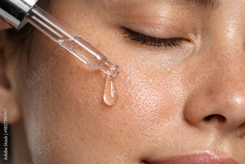 A high-quality, clinical close-up photograph of a woman’s face with freckles as a glass dropper applies a clear, hydrating liquid serum to her cheek, perfectly highlighting professional skincare treat