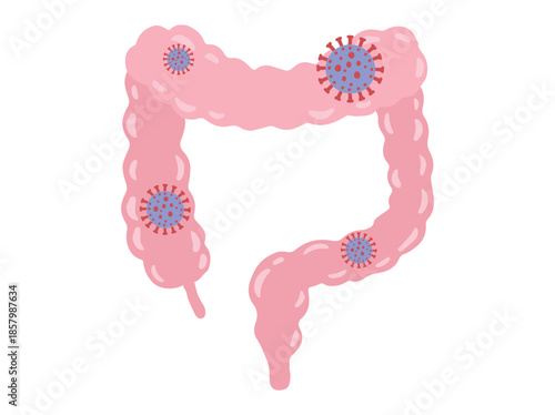 Hand Drawn infection Disease in Intestines
