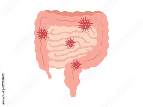 infection Disease in Intestines Clip Art
