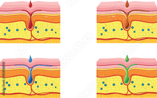 Human skin layers absorption illustration set showing liquid penetration pores epidermis dermis isolated vector design for medical skincare education concepts