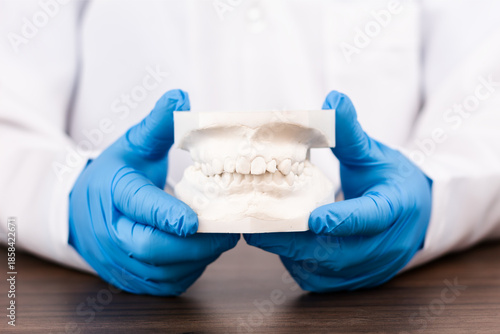 Fotografi Orthodontic treatment planning with dental plaster model, dentist analyzing upper and lower jaw malocclusion, modern clinical dentistry concept