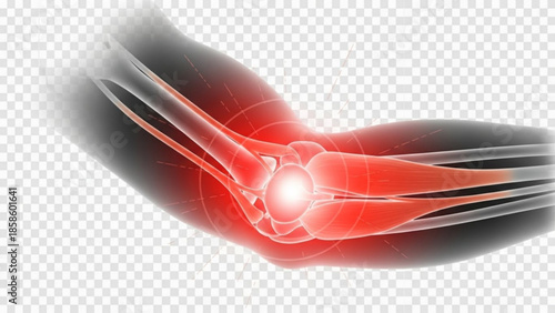 Elbow joint pain and inflammation in human arm with highlighted bones and tendons