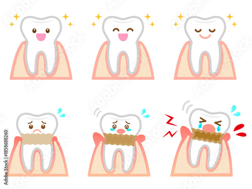 歯周病の歯茎と歯のイラスト素材セット2