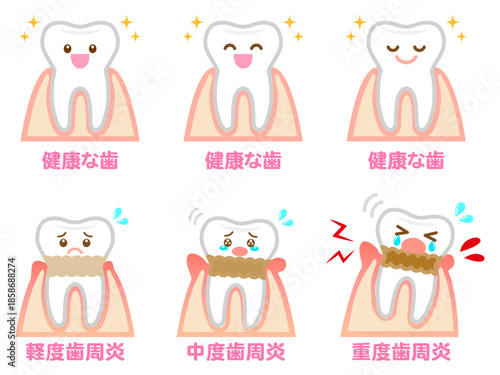 歯周病の歯茎と歯のイラスト素材セット