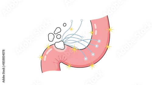 Medical illustration of a digestive organ with an implanted device and multiple wires, surrounded by sparkling effects