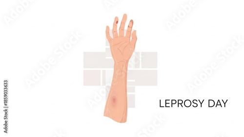 A graphic illustration of a human arm with a visible skin lesion, raised in a gesture, on World Leprosy Day, set against a clean white background with a subtle cross symbol.