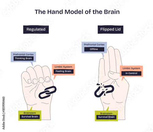 Hand brain model contrasts regulation vs flipped lid with fist and open hand, shows prefrontal cortex, limbic system, brainstem, and a broken link symbolizing disconnection. Diagram