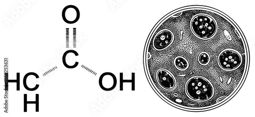 formic acid molecular structure and bacterial culture plate