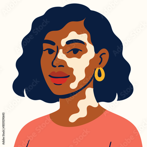 Minimal Flat Vector Portrait of a Confident Woman with Vitiligo, Beauty Diversity and Self-Love Concept Illustration on White Background