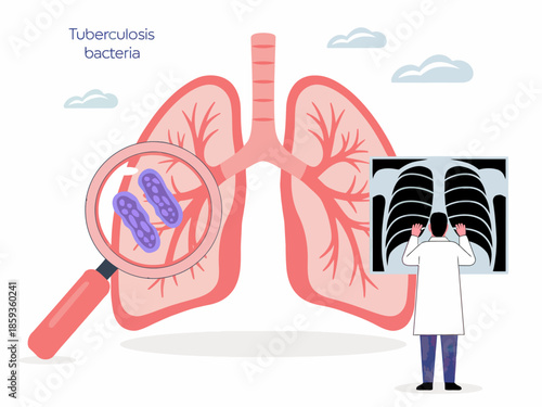 Doctor examining lungs with tuberculosis bacteria illustration