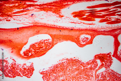 Microscopic image of human skeletal muscle tissue showing organized striated fibers stained in red, highlighting muscle bundles and connective tissue divisions.