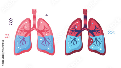 Medical illustration showing a comparison of healthy lungs and lungs affected by pleural effusion or water, isolated on white background.