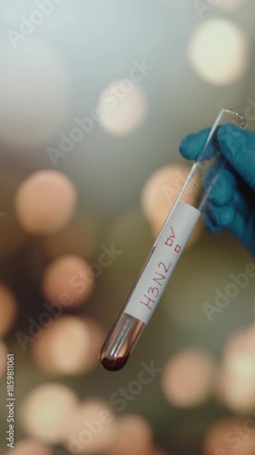 Gloved Hand Holding H3N2 Blood Sample for Virus Testing