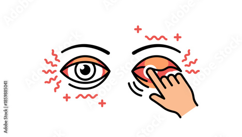 Red irritated human eyes with hands rubbing them illustrating allergic reaction and conjunctivitis symptoms
