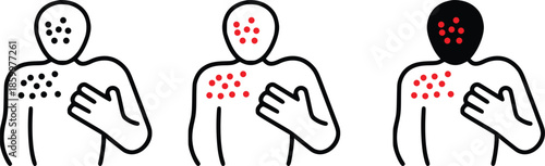 set of representation of various skin conditions and rash symptoms on the human body vector set