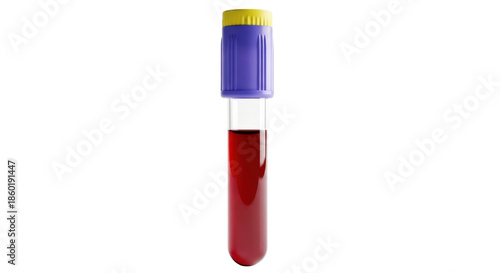 Single blood sample in clear glass tube with blue and yellow cap vial medical, Isolated On Png Transparent Background