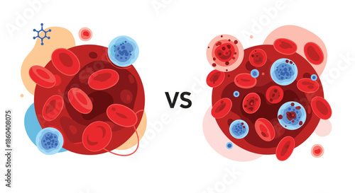 Comparative illustration showing normal healthy blood cells versus infected or diseased blood cells, representing medical differences and illness.