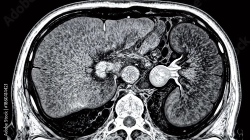 Medical scan of abdominal organs
