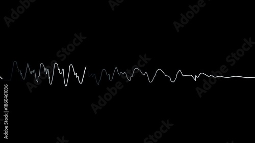 Electrocardiogram ECG signal displayed waveform representing heart rate monitoring cardiology and medical technology.Concept of healthcare pulse measurement and visualization on black background.