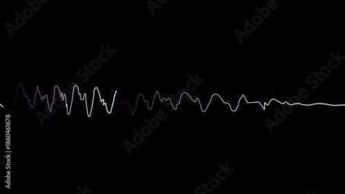 Electrocardiogram ECG signal displayed waveform representing heart rate monitoring cardiology and medical technology.Concept of healthcare pulse measurement and visualization on black background.