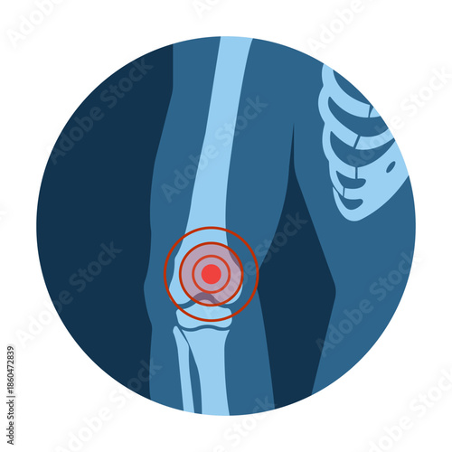 Joint Pain Illustration: A medical illustration highlights a painful knee joint. The image utilizes an x-ray effect, emphasizing the area of discomfort.