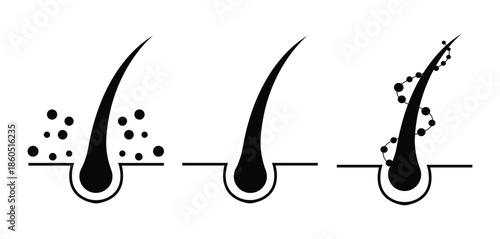 Hair icon in linear, outline icon isolated on white background. Hair Follicle Anatomy and Growth Cycle Stages Illustrated with Diagrams Representing Different Skin Conditions.