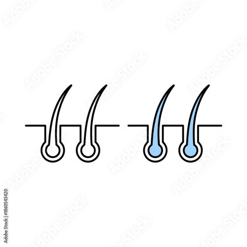 Illustration depicting hair follicles in various stages of growth and health